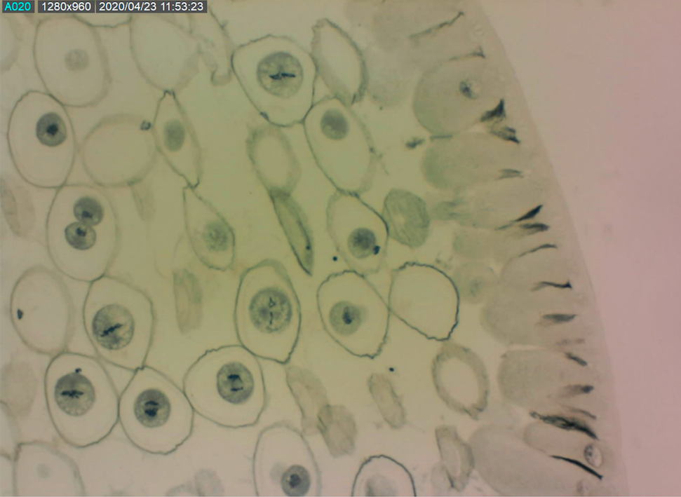 1 calculate mitotic index in plant onion and animal liver cells the ... Biology Diagrams