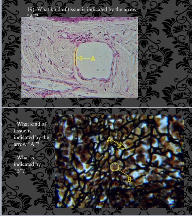 19-what-kind-of-tissue-is-indicated-by-the-arrow-a-what-kind-of-tissue