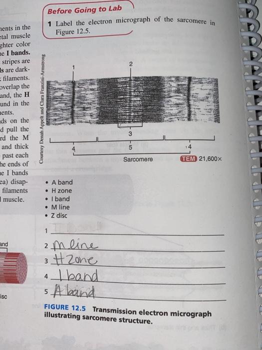 Before Going Lab Label The Electron Micrograph The Sarcomere In Figure