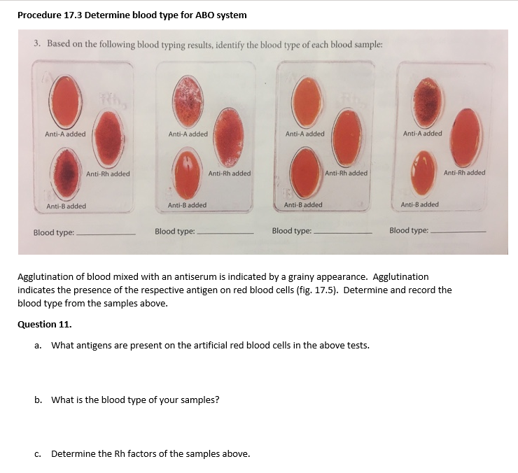 procedure 173 determine blood type for abo system 3 based on the